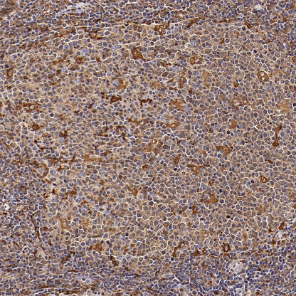 FTH1 Recombinant Rabbit mAb (S-1372-136)