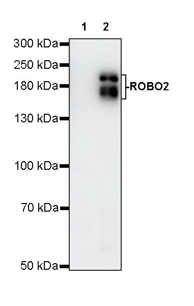 ROBO2 Recombinant Rabbit mAb (S-4563-43)