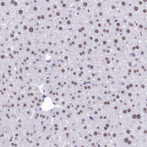 U2AF2 Recombinant Rabbit mAb (S-1324-1)