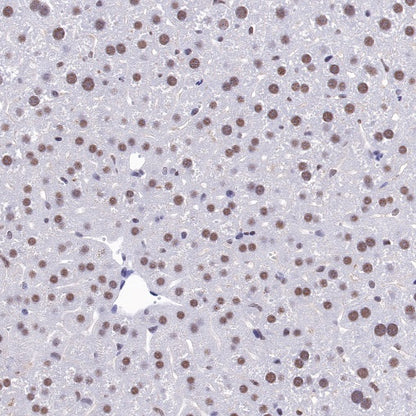 U2AF2 Recombinant Rabbit mAb (S-1324-1)