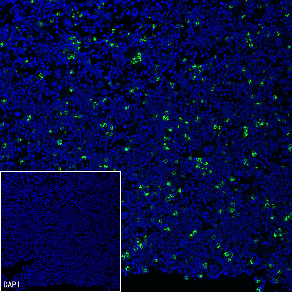 Neutrophil Elastase Recombinant Rabbit mAb (S-4397-22)