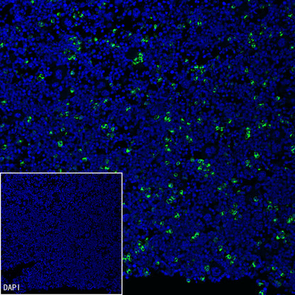 Neutrophil Elastase Recombinant Rabbit mAb (S-4397-22)