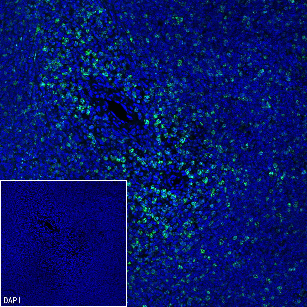 Ki67 Recombinant Rabbit mAb (S-4923-15)