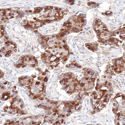 S-RMab® GCDFP-15 Recombinant Rabbit mAb (SDT-R030)