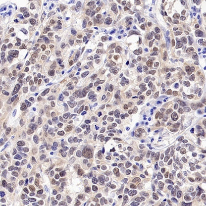 CDKN2A/p16 INK4A Recombinant Rabbit mAb (S-4676)
