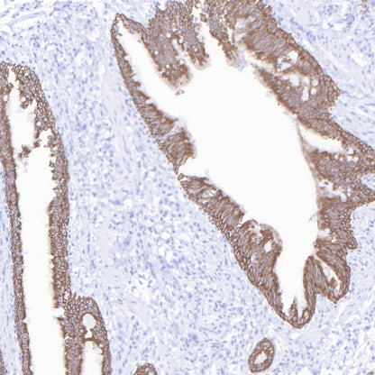 S-RMab® CK-Pan Recombinant Rabbit mAb (SDT-P001)