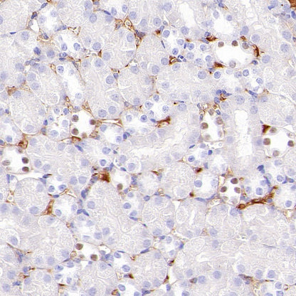 AP2α Recombinant Rabbit mAb (S-2376-7)