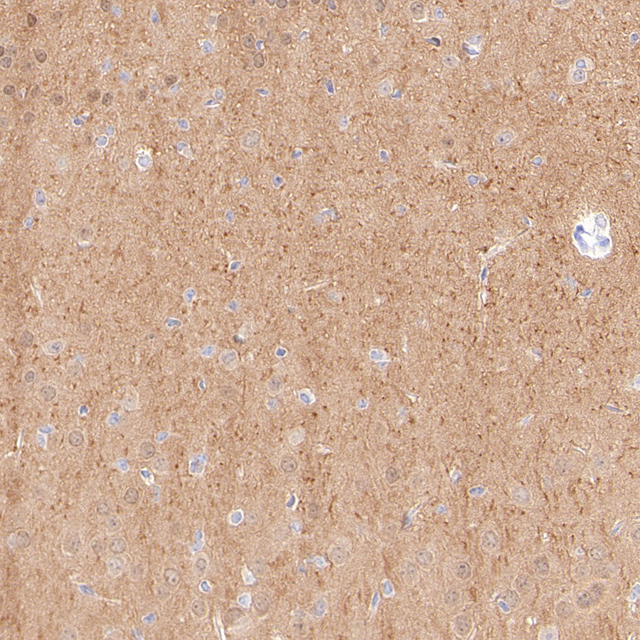 PGP9.5 Recombinant Mouse mAb (S-6071)