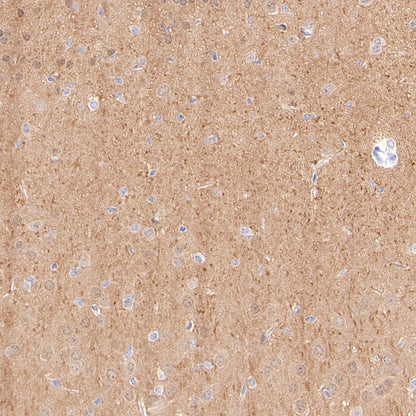 PGP9.5 Recombinant Mouse mAb (S-6071)