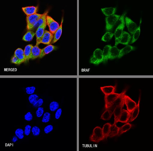 BRAF Recombinant Rabbit mAb (S-1328-60)