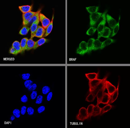BRAF Recombinant Rabbit mAb (S-1328-60)
