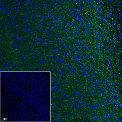 MAP2 Recombinant Rabbit mAb (S-3110-72)