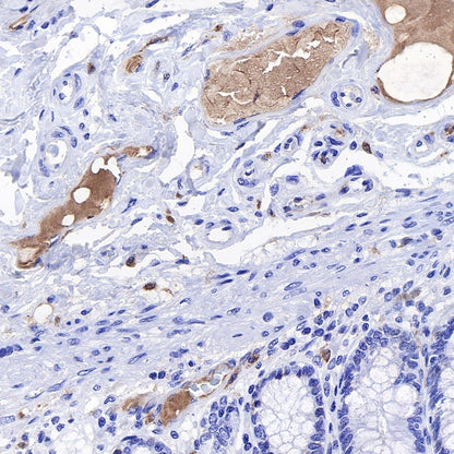 C1q Recombinant Rabbit mAb (S-472-105)