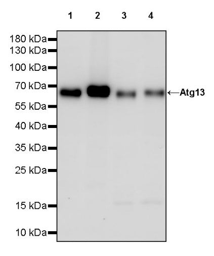 Atg13 Recombinant Rabbit mAb (S-2534-22)