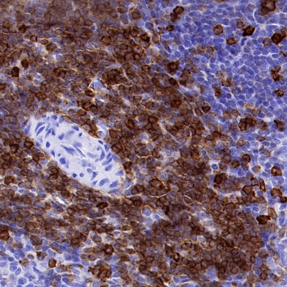 CD5 Recombinant Rabbit mAb (SDT-2570-53)