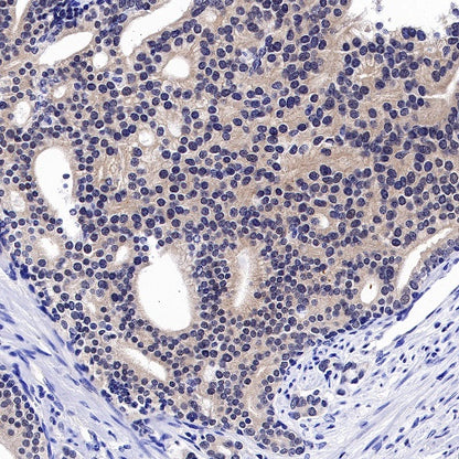 JNK1 Recombinant Rabbit mAb (S-1153-21)
