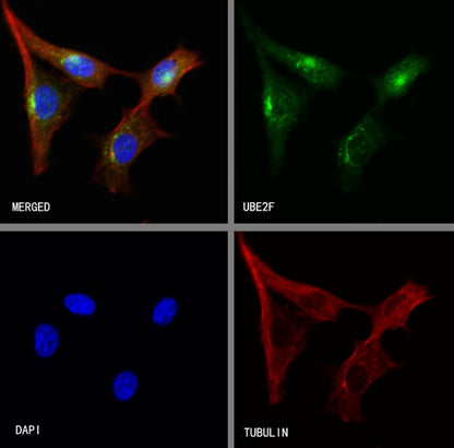 UBE2F Recombinant Rabbit mAb (S-2672-26)