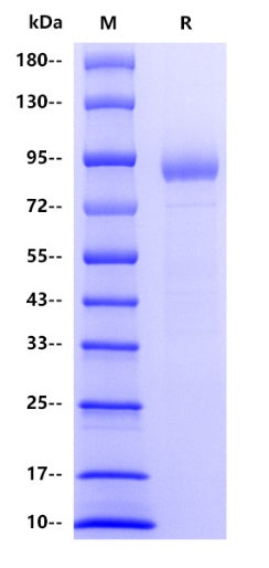 Human beta Galactosidase/GLB1 Protein, His tag