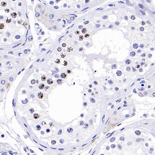 Phospho-Histone H2A.X (Ser139) Recombinant Rabbit mAb (S-1368-15)