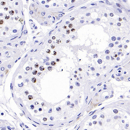 Phospho-Histone H2A.X (Ser139) Recombinant Rabbit mAb (S-1368-15)