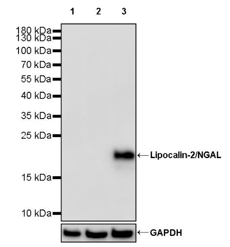 Lipocalin-2/NGAL Recombinant Rabbit mAb (S-2279-72)