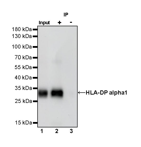 HLA-DP alpha1 Recombinant Rabbit mAb (S-R243)