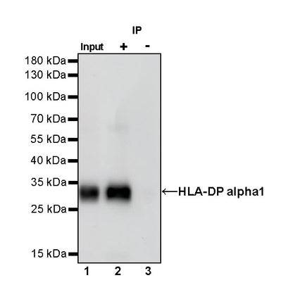 HLA-DP alpha1 Recombinant Rabbit mAb (S-R243)