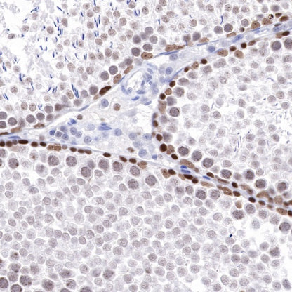 PARP1 Recombinant Rabbit mAb (S-220-179)