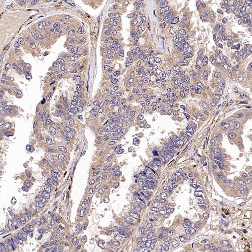 TYK2 Recombinant Rabbit mAb (S-2740-165)