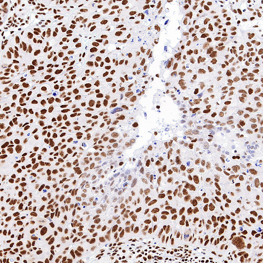 PABPN1 Rabbit Polyclonal Antibody