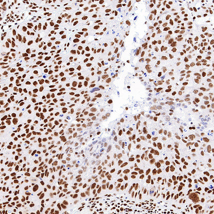 PABPN1 Rabbit Polyclonal Antibody