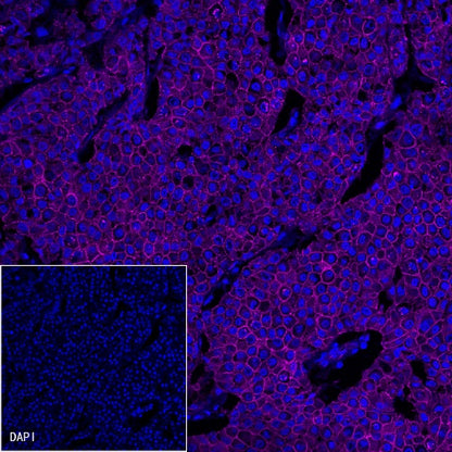 β-Catenin Recombinant Rabbit mAb (Cy5 Conjugate) (S-336-23)