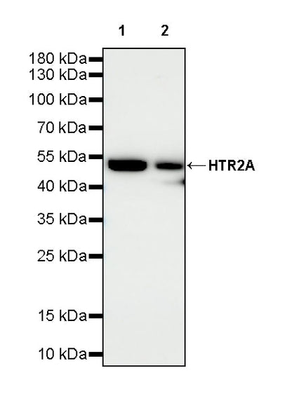 HTR2A Recombinant Rabbit mAb (S-4426-14)
