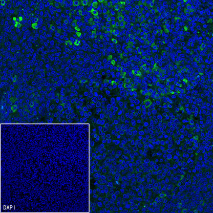 CD10 Recombinant Rabbit mAb (SDT-006-77)