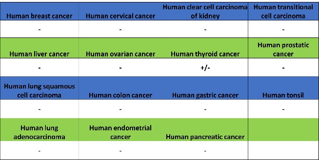 CaMKII alpha Recombinant Rabbit mAb (S-2451-54)
