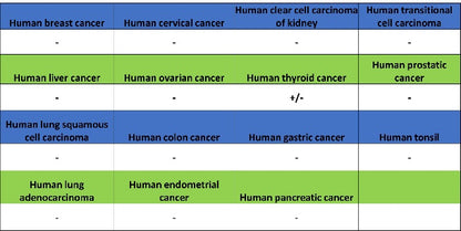 CaMKII alpha Recombinant Rabbit mAb (S-2451-54)