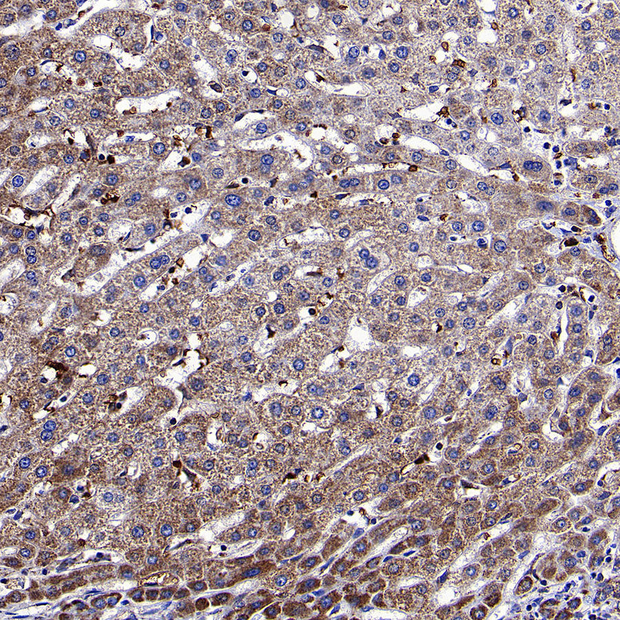 NDUFB8 Recombinant Rabbit mAb (S-4770-29)