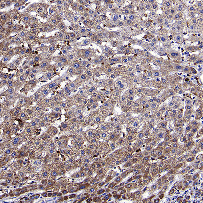 NDUFB8 Recombinant Rabbit mAb (S-4770-29)