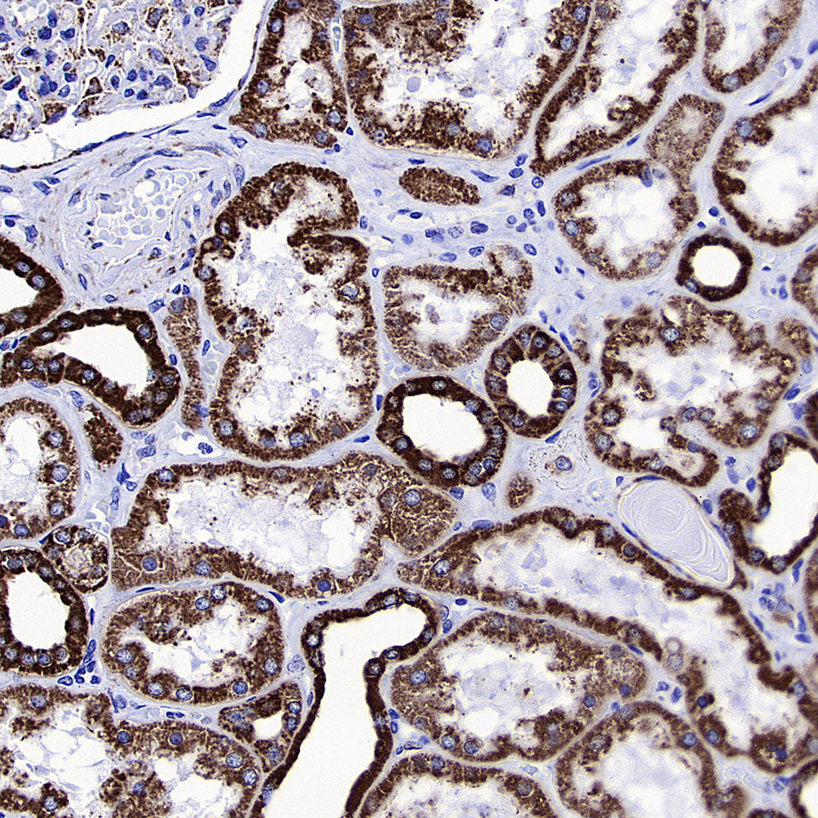 VDAC1 Recombinant Rabbit mAb (S-5314)