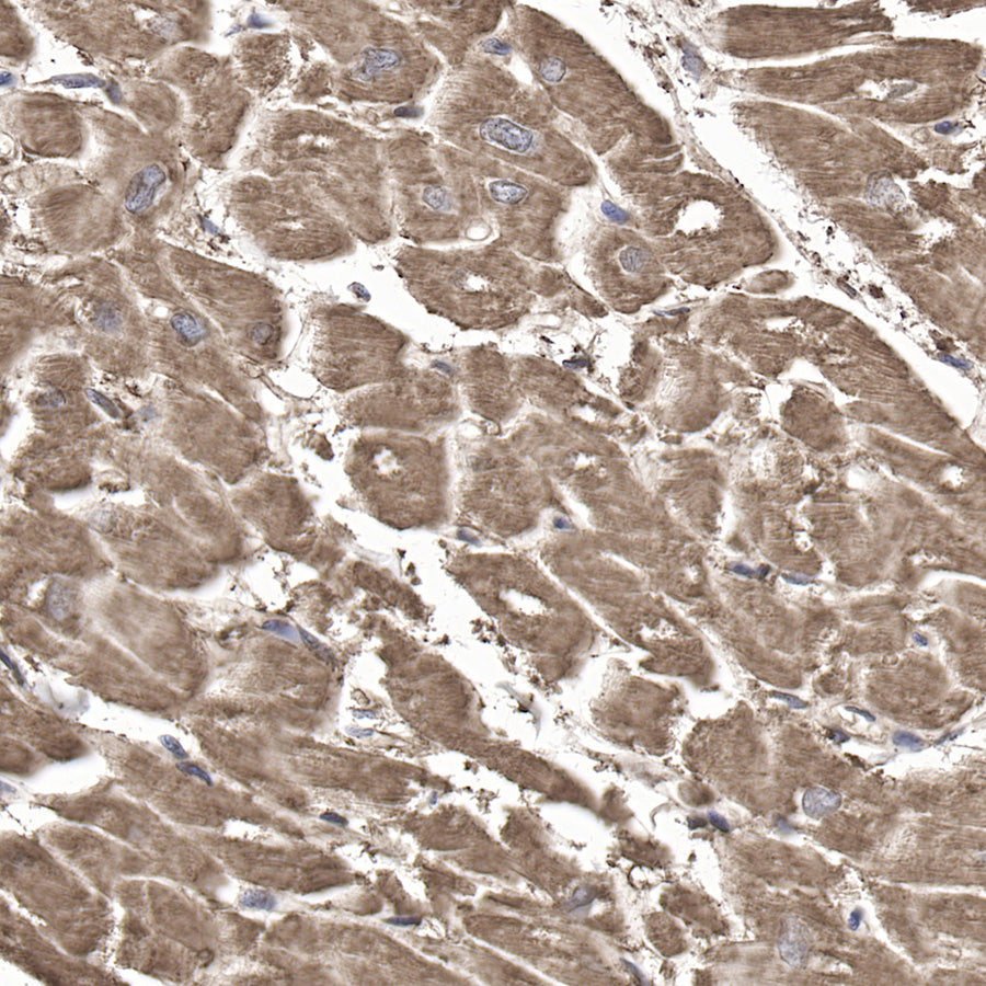 Myoglobin Recombinant Rabbit mAb (SDT-097-10)