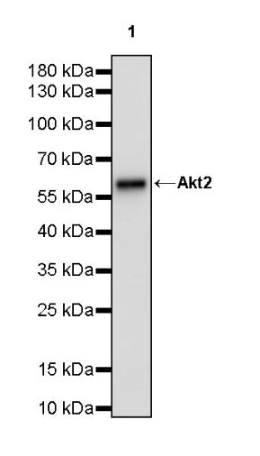 AKT2 Recombinant Rabbit mAb (S-3256)