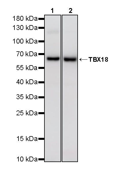 TBX18 Recombinant Rabbit mAb (S-4619-17)