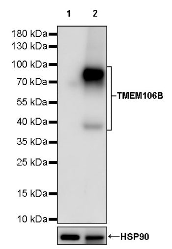 TMEM106B Recombinant Rabbit mAb (S-2362-33)