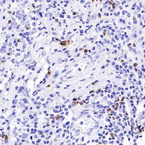 CXCL13 Recombinant Rabbit mAb (SDT-2703-132)