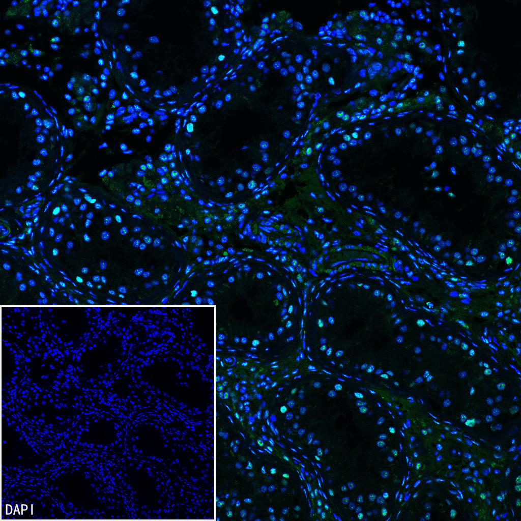 PABPN1 Rabbit Polyclonal Antibody