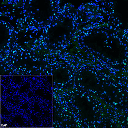 PABPN1 Rabbit Polyclonal Antibody
