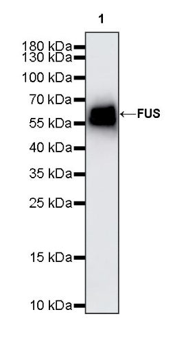 FUS Recombinant Rabbit mAb (S-1015-21)