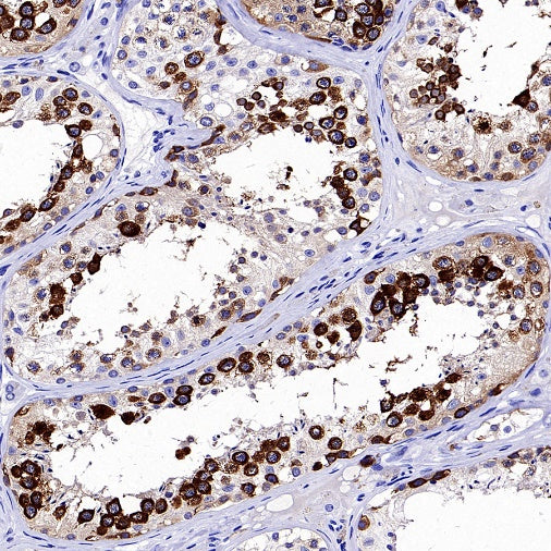TACC3 Recombinant Rabbit mAb (S-3048-50)