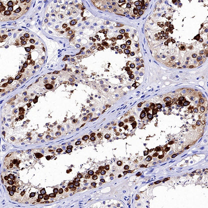 TACC3 Recombinant Rabbit mAb (S-3048-50)