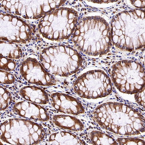 Dynamin 2 Recombinant Rabbit mAb (S-1751-209)